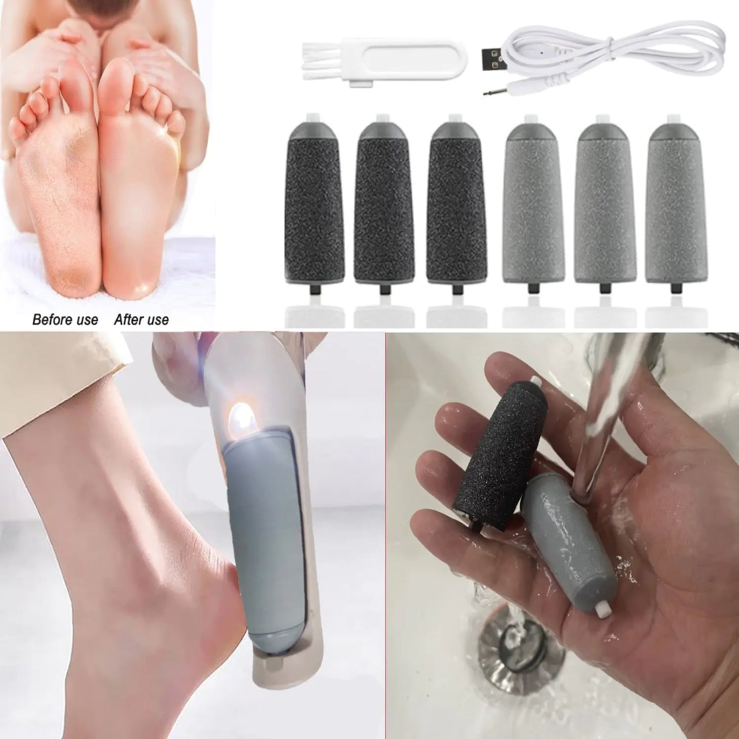 Electric Foot File Callus Remover